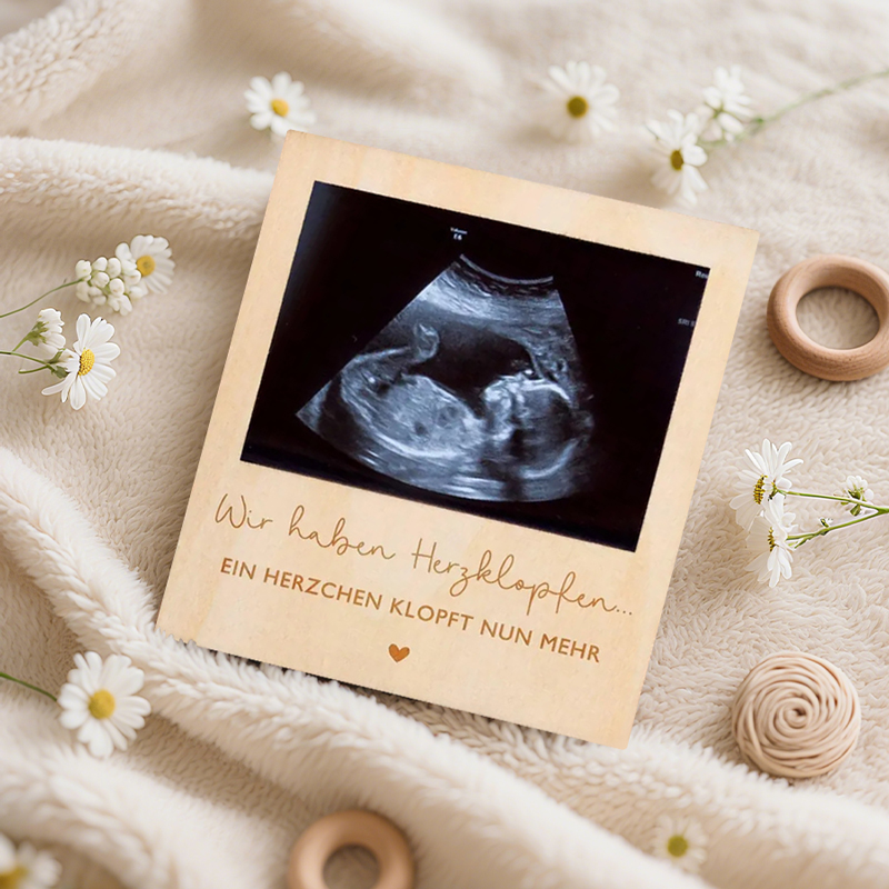 Ultrasound Pregnancy Announcem - огляд і ціна Baby Nursery Images